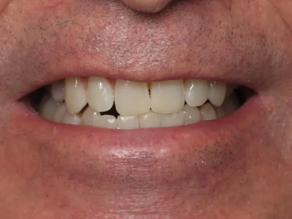 Before image