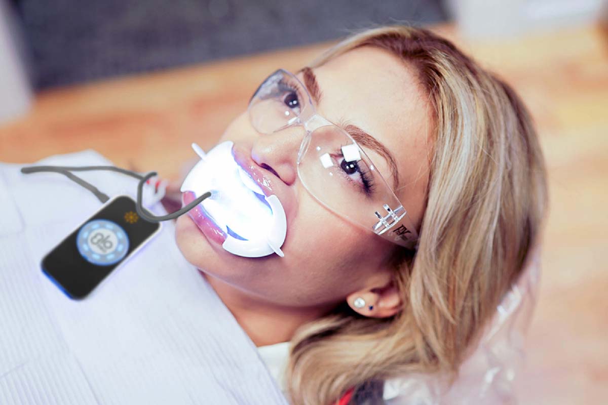 patient getting their teeth whitened at Willow Park, TX dental office W Dental