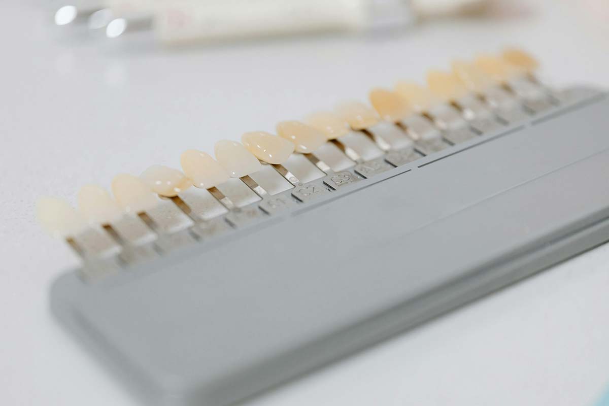 lineup of dental veneers colors offered at W Dental in Willow Park, TX