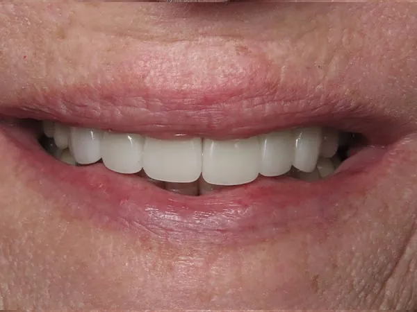 After image