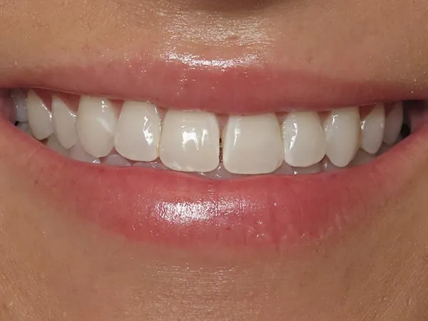 Before image
