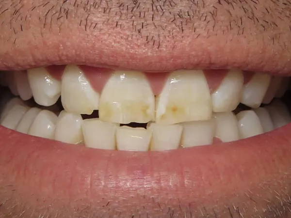 Before image