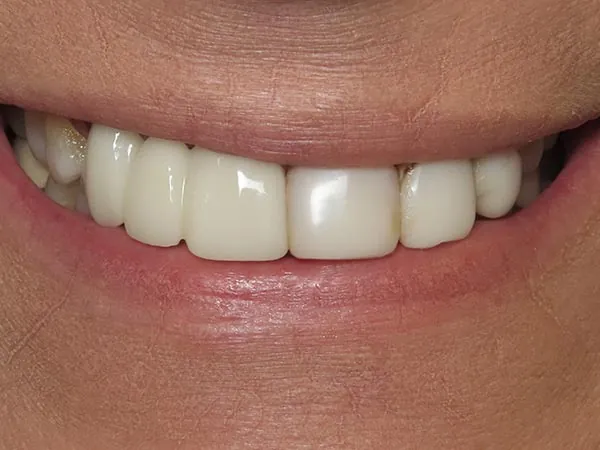 Before image