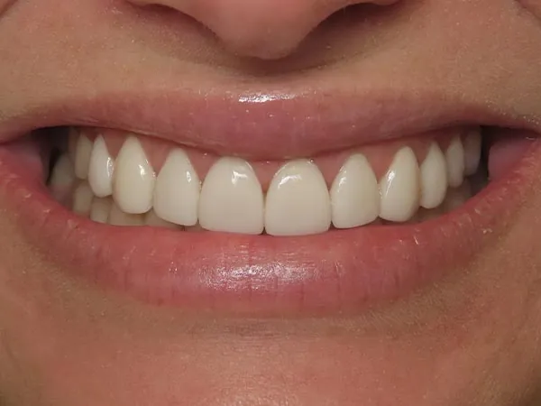 After image