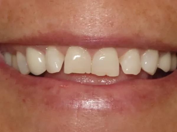 Before image