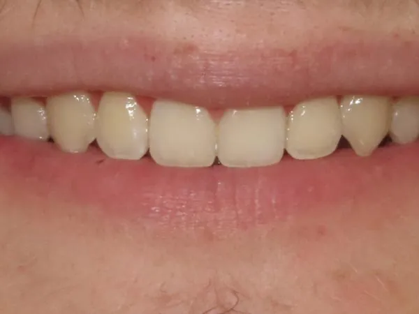 After image