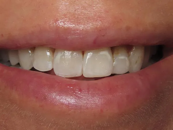 Before image
