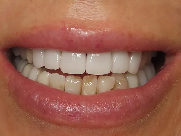 Before image