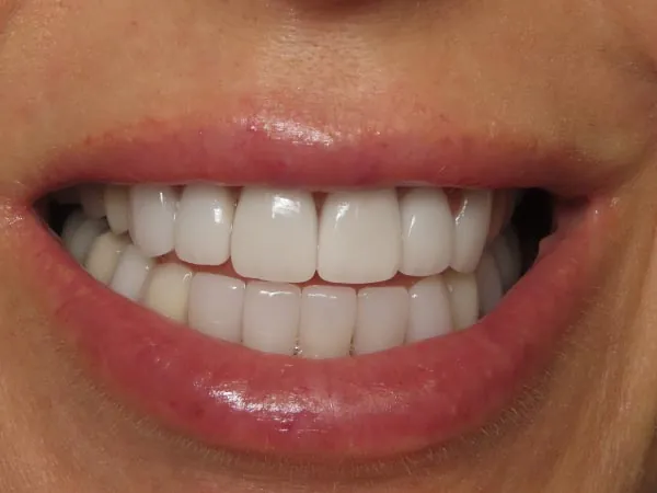 After image