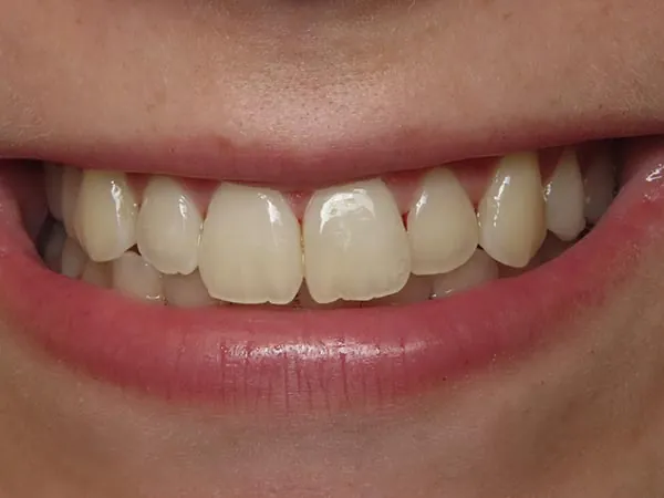 Before image